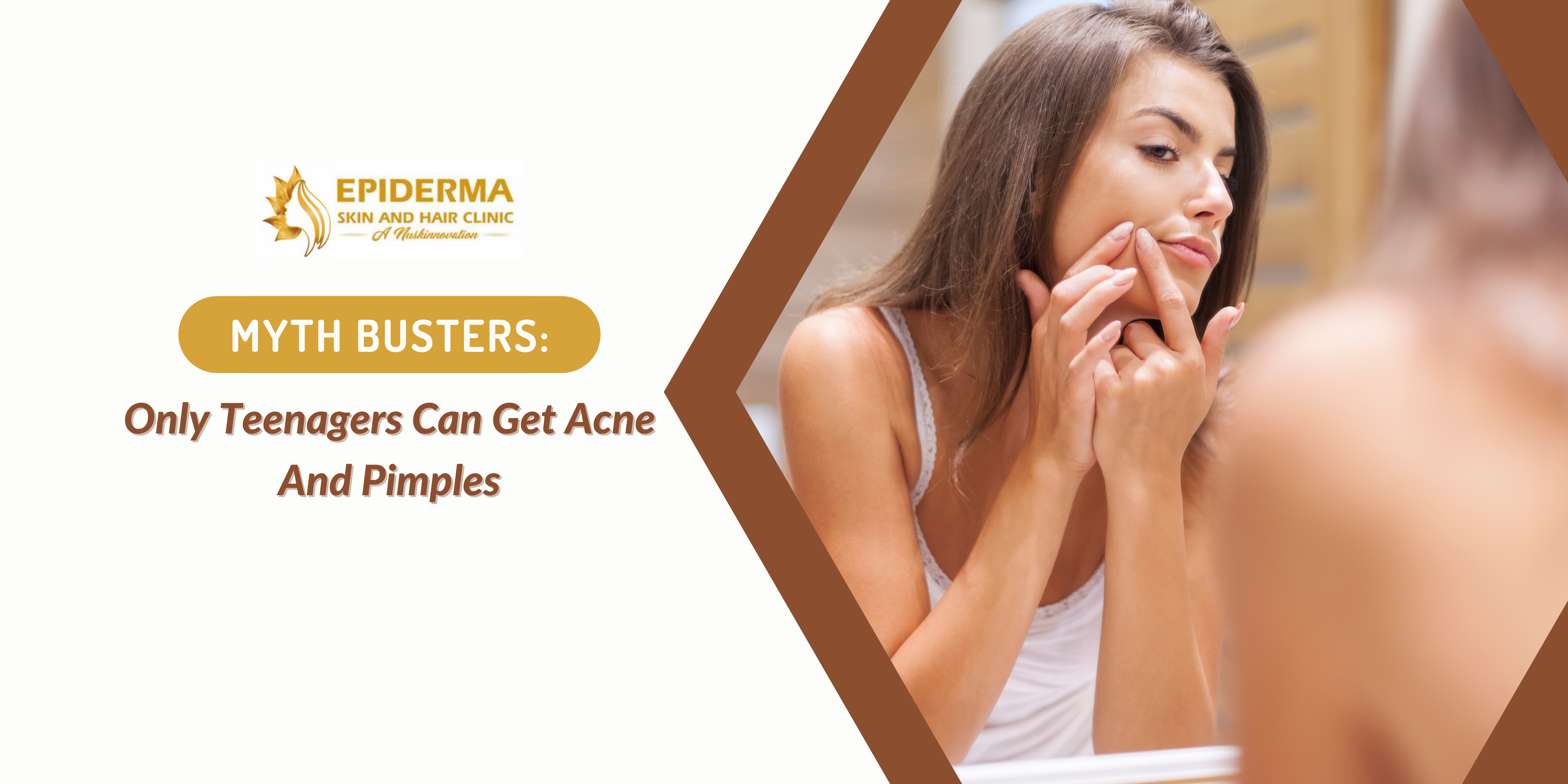 Myth busters on Acne - Epiderma Clinic